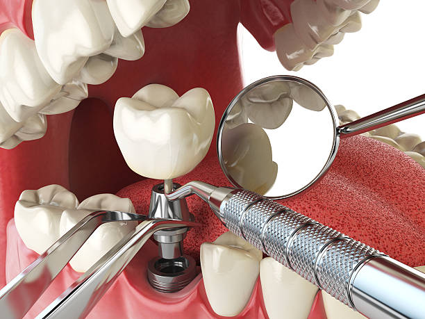 Best Emergency Dental Care for Broken or Chipped Teeth in Walnut Hill, TN